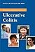 Questions & Answers about Ulcerative Colitis