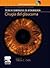 Cirugia del Glaucoma: -