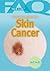 Frequently Asked Questions About Skin Cancer (FAQ: Teen Life, 3)
