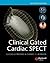 Clinical Gated Cardiac Spect