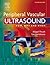 Peripheral Vascular Ultrasound by Abigail Thrush BSc(Physics)...
