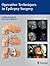 Operative Techniques in Epilepsy Surgery