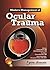 Modern Management of Ocular Trauma by Samuel Boyd