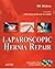 Laparoscopic Hernia Repair