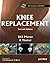Knee Replacement