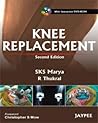 Knee Replacement by Sks Marya