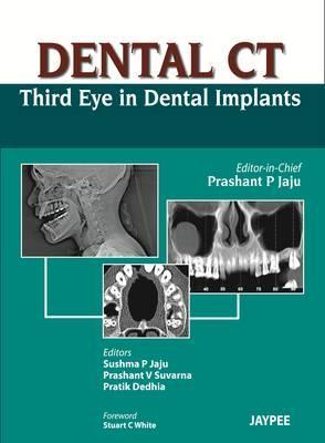 Dental CT: Third Eye in Dental Implants