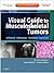 Visual Guide to Musculoskeletal Tumors: A Clinical - Radiologic - Histologic Approach E-Book