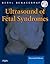 Ultrasound of Fetal Syndromes by Beryl R. Benacerraf MD