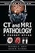 CT & MRI Pathology by Michael L. Grey