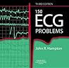 150 ECG Problems