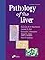 Pathology of the Liver by Roderick N.M. MacSween