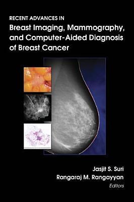 Recent Advances in Breast Imaging, Mammography, and Computer-Aided Diagnosis of Breast Cancer (SPIE Press Monograph Vol. PM155)