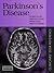 Parkinson's Disease by Donald Grosset