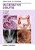 Ulcerative Colitis (Visual Guide for Clinicians)