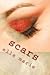 Scars