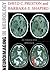 Neuroimaging in Neurology: An Interactive CD