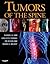 Tumors of the Spine