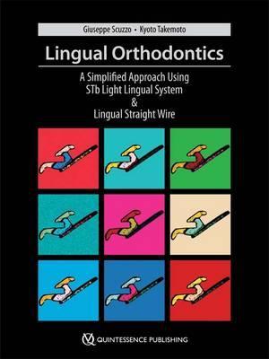 Lingual Orthodontics: A New Approach Using Stb Light Lingual System & Lingual Straight Wire