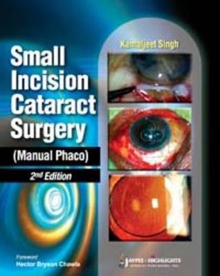 Small Incision Cataract Surgery: Manual Phaco