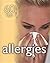 Allergies: 60 tips