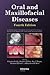Oral and Maxillofacial Dise...