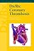 Dx/Rx: Coronary Thrombosis (Dx/Rx Cardiology Series)