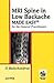 MRI Spine in Low Backache Made Easy for the General Practitio... by G. Balachandran