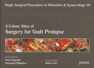 Uterus - Displacement: A Colour Atlas of Surgery for Vault Prolapse (Single Surgical Procedures in Obstetrics and Gynaecology)