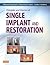 Principles and Practice of Single Implant and Restoration