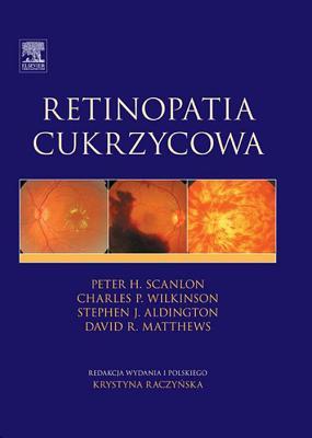 Retinopatia Cukrzycowa