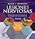 Kline y Hudson. Lesiones nerviosas: Resultados del tratamiento quirúrgico de los traumatismos, los atrapamientos y los tumores de los nervios principales