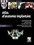 Atlas D'Anatomie Implantaire