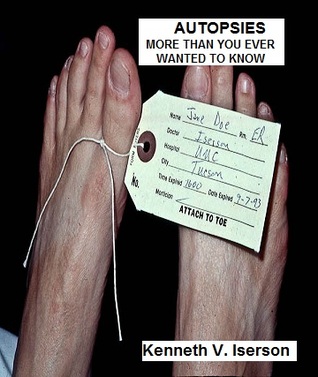 Autopsies: More than you ever wanted to know