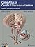 Color Atlas of Cerebral Revascularization: Anatomy, Techniques, Clinical Cases