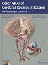 Color Atlas of Cerebral Revascularization: Anatomy, Techniques, Clinical Cases