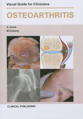 Osteoarthritis (Visual Guide for Clinicians)