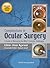 Complications in Ocular Surgery: A Guide to Managing the Most Common Challenges