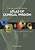 Cornea and Refractive Atlas of Clinical Wisdom