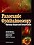 Panoramic Ophthalmoscopy: Optomap Images and Interpretation