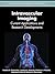Intravascular Imaging: Current Applications and Research Developments