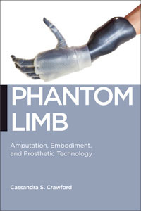 Phantom Limb: Amputation, Embodiment, and Prosthetic Technology (Biopolitics, 16)