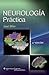 Neurología práctica (Spanish Edition)