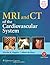MRI and CT of the Cardiovascular System