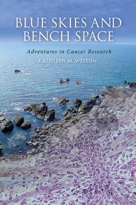 Blue Skies and Bench Space: Adventures in Cancer Research