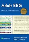 Adult EEG: An Int...