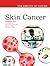 Skin Cancer (The Biology of Cancer)