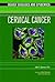 Cervical Cancer