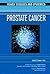 Prostate Cancer