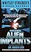 Casebook: Alien Implants
